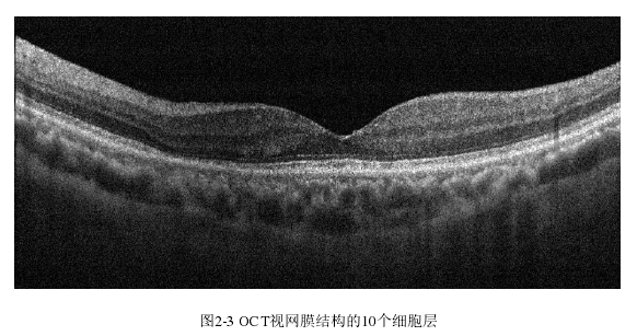 图2-3 OCT视网膜结构的10个细胞层