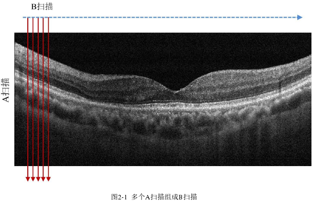 图2-1  多个A扫描组成B扫描 