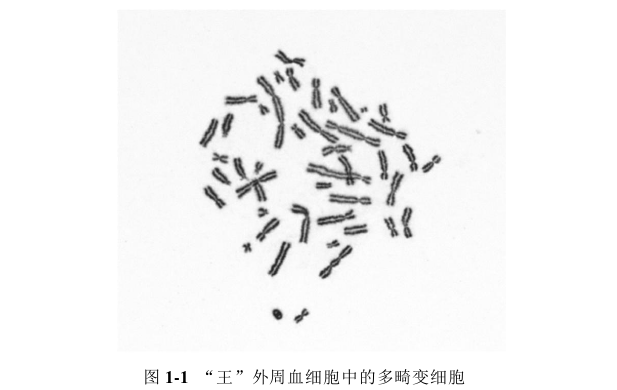 放射医学论文怎么写