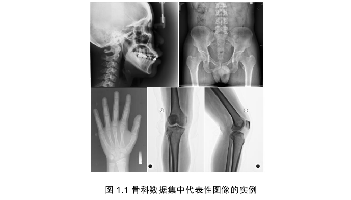 软件工程硕士论文怎么写